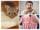 Doenças transmitidas por roedores