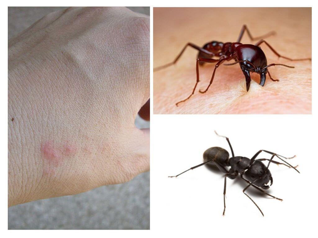 Mordidas de formiga
