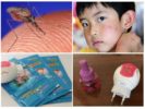 Çocuk Raptor Nekusayka sivrisineklere karşı koruyacak
