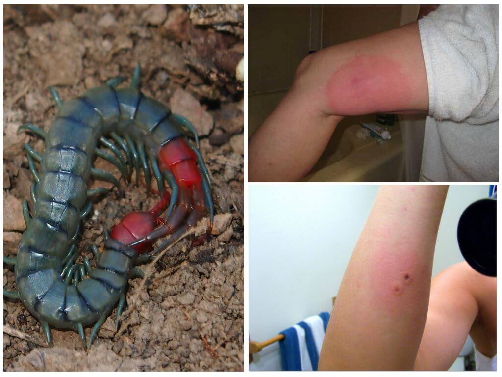 What to do if a scolopendra has bitten