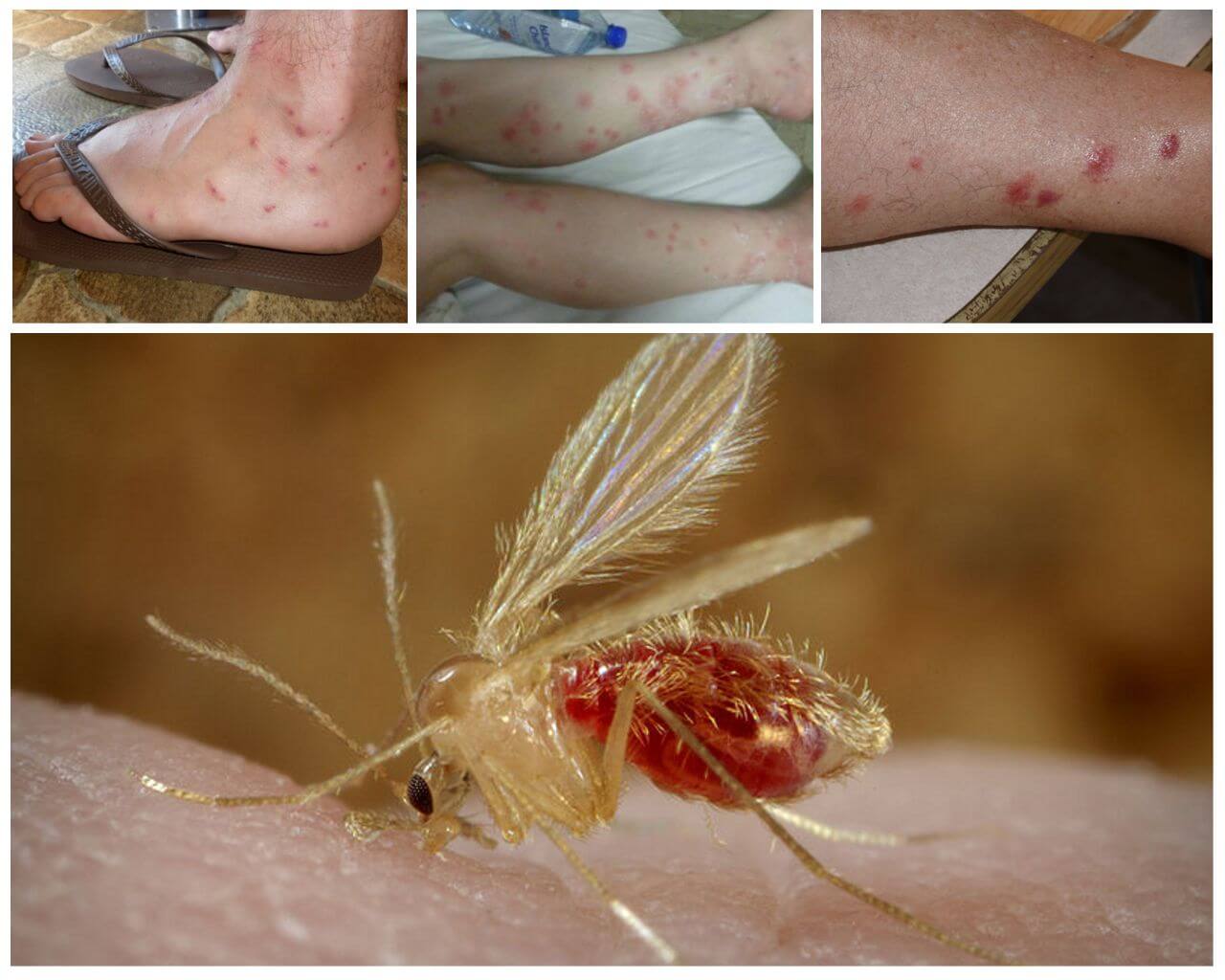 תיאור ותצלומים של יתושים