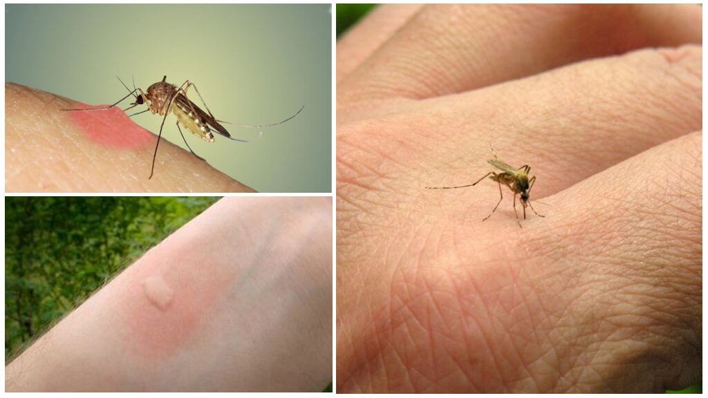 Por que os mosquitos mordem algumas pessoas mais do que outras