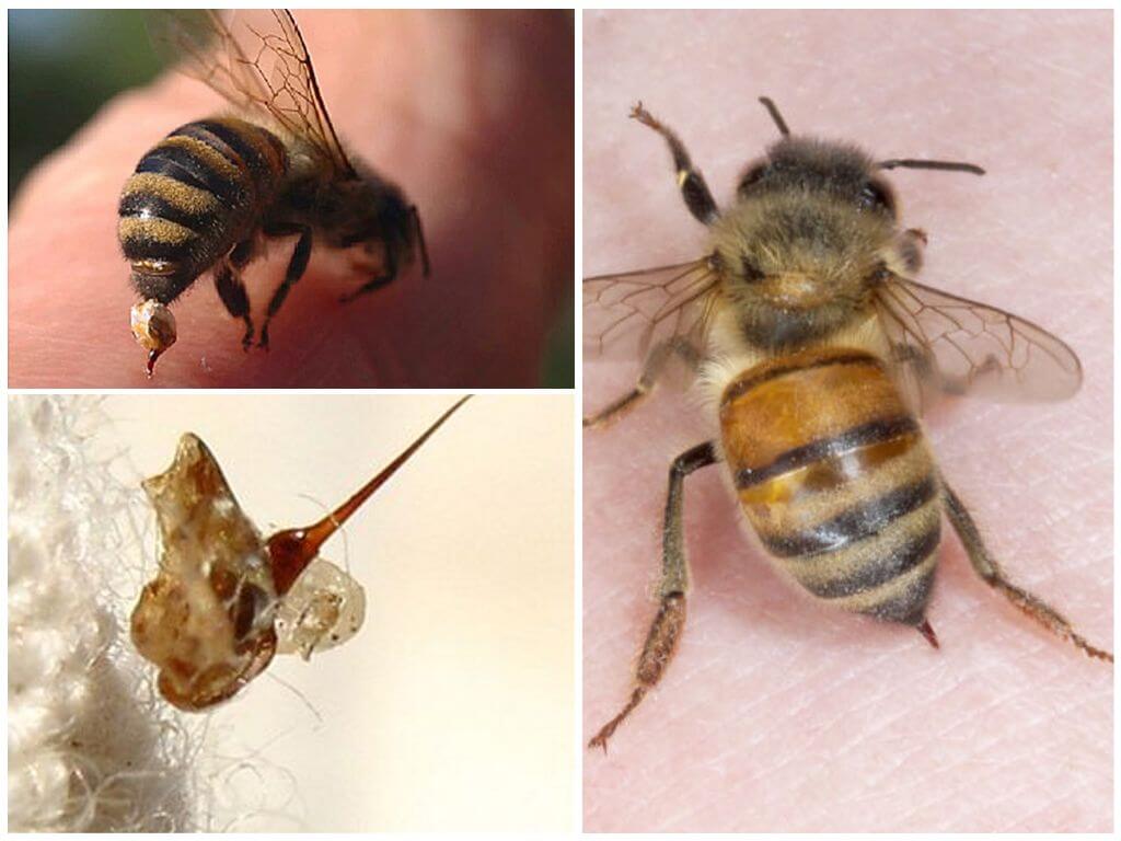 Sting de albine și viespe