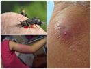De gevolgen van een beet van een paardevlieg