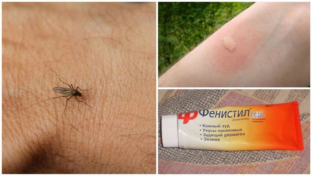 Làm thế nào và làm thế nào để loại bỏ ngứa từ muỗi đốt ở trẻ em và người lớn