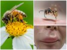 Méh csíp az ajkán
