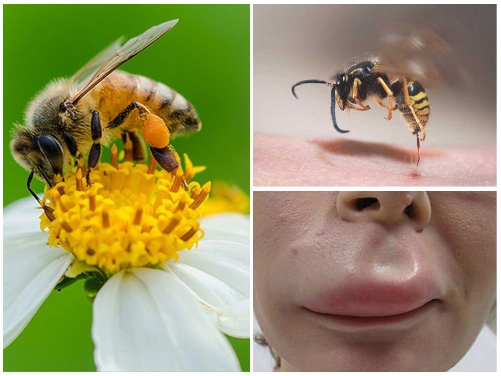 O que fazer se uma abelha morder um lábio