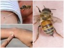 Ползите от ужилване от пчела