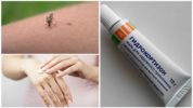 Hydrocortisonzalf voor muggenbeten