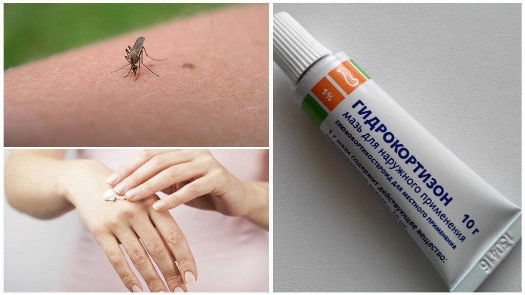 Sivrisinek ısırıkları için hidrokortizon merhem