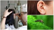 יתוש באוזן