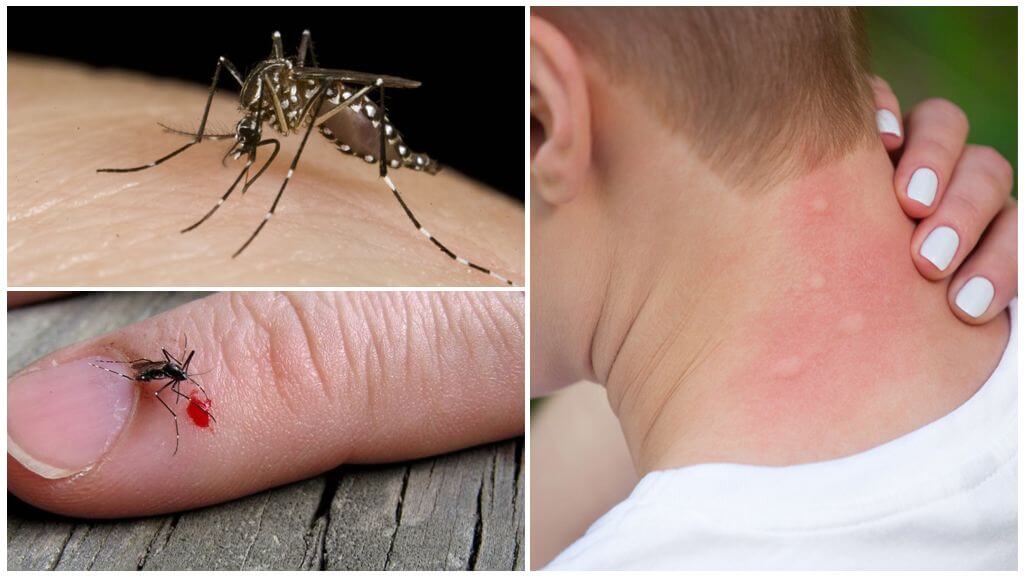 Hvad skal man gøre, hvis en myg er lidt