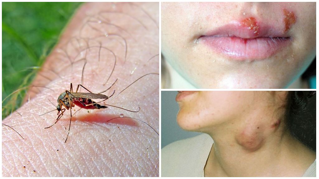 Vilka sjukdomar bär myggor?