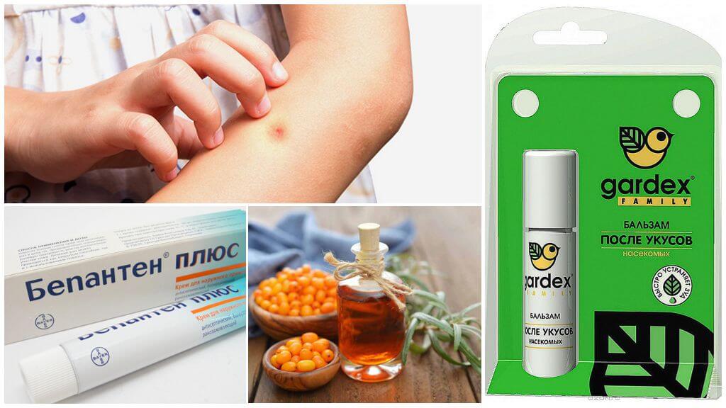 Magazin și remedii populare pentru mușcăturile de țânțar și midges