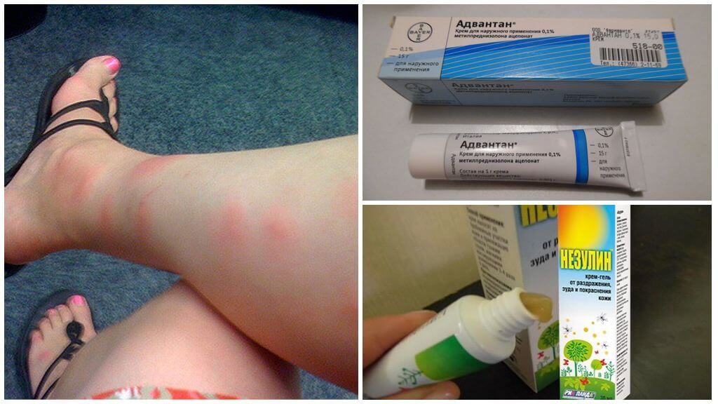 Per què els adults i els nens després de picades de mosquit apareixen cops de porra que no pas per tractar