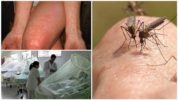 Dengue e febre de Chikungunya de mosquitos