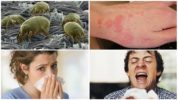 Алергия от кърлежи от леглото