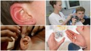 Цялостно лечение на ушен кърлеж