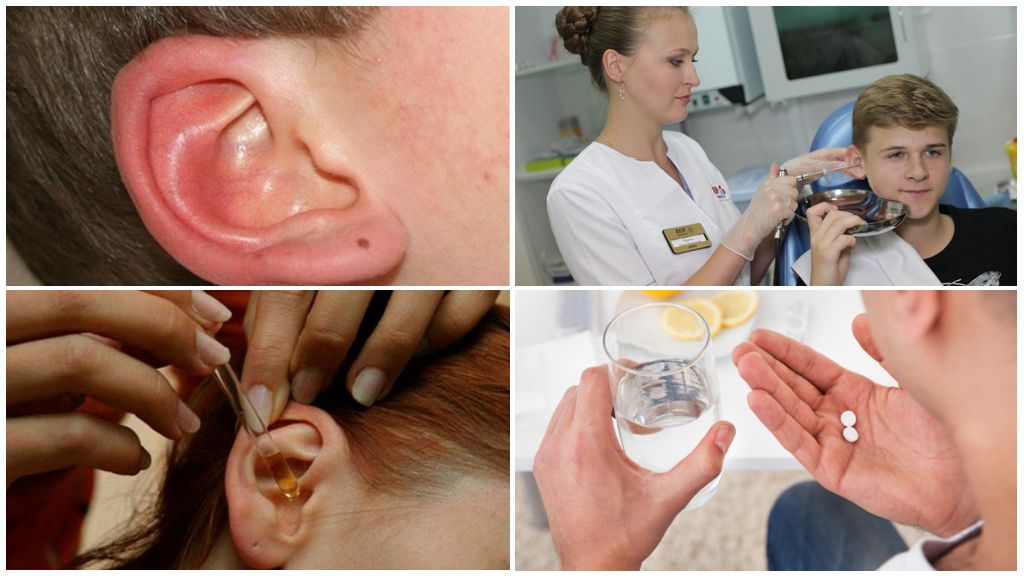 Carrapato no ouvido em humanos: sintomas e tratamento