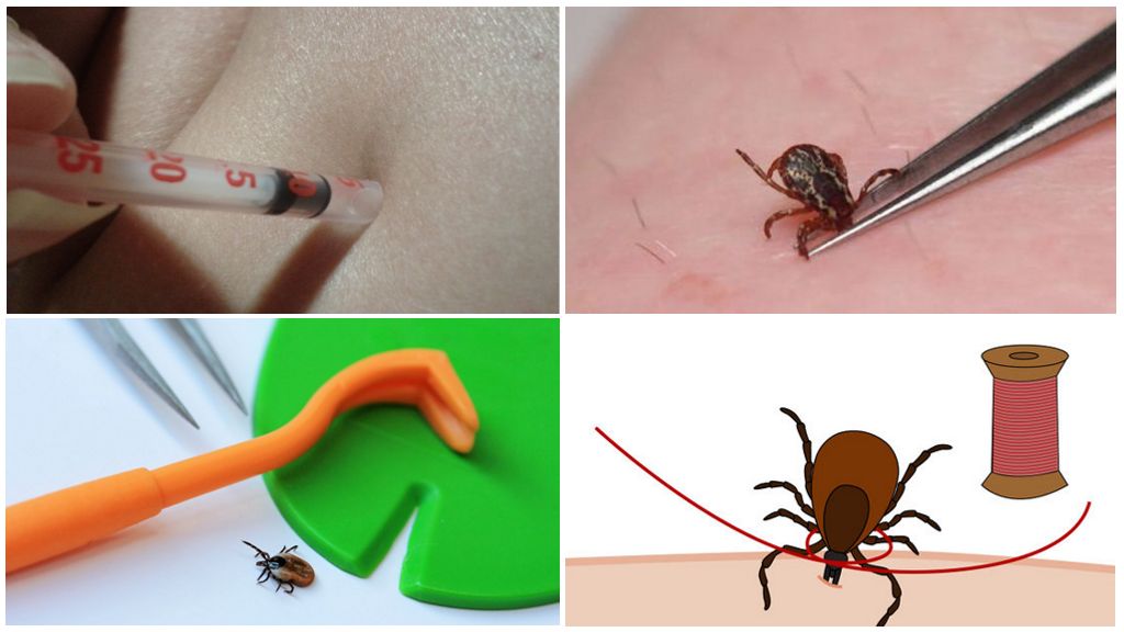 Một con bọ có thể bị nghiền nát bằng ngón tay