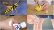 תרופות עממיות לעקיצות חרקים