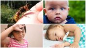 Συστηματικές αλλεργίες μετά από τσίμπημα στη σφήκα