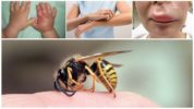 Reagointi ampiaispistokseen lapsessa