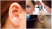 Côn trùng trong tai