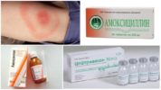 Mga antibiotics para sa Borreliosis