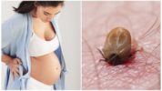 עקיצת קרציות במהלך ההיריון