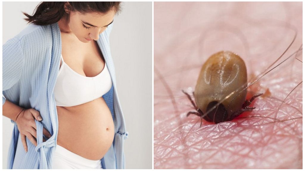 Phải làm gì nếu phụ nữ mang thai bị bọ ve cắn
