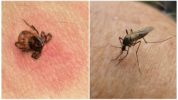 עקיצת קרציות ויתושים